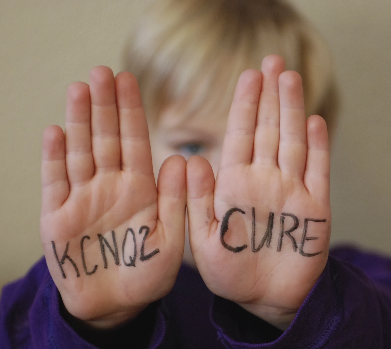 kcnq2 hands